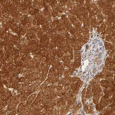 Immunohistochemistry-Paraffin: GSTZ1 Antibody [NBP1-83320] - Staining of human liver shows strong cytoplasmic positivity in hepatocytes.