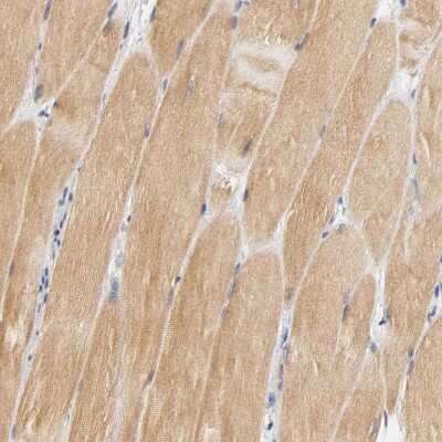 Immunohistochemistry-Paraffin: GSTZ1 Antibody [NBP1-83320] - Staining of human skeletal muscle shows moderate cytoplasmic positivity in myocytes.