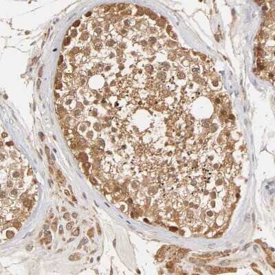 Immunohistochemistry-Paraffin: GSTZ1 Antibody [NBP1-83320] - Staining of human testis shows strong cytoplasmic positivity in cells in seminiferous ducts and leydig cells.