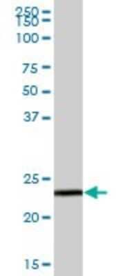 Western Blot: GSTZ1 Antibody [H00002954-B01P] - Analysis of GSTZ1 expression in human liver.