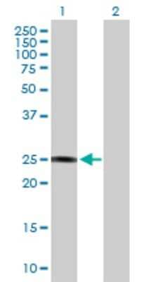 Western Blot: GSTZ1 Antibody [H00002954-B01P] - Analysis of GSTZ1 expression in transfected 293T cell line by GSTZ1 polyclonal antibody.  Lane1:GSTZ1 transfected lysate(23.76 KDa). Lane2:Non-transfected lysate.