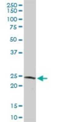 Western Blot: GSTZ1 Antibody [H00002954-D01P] - Analysis of GSTZ1 expression in human liver.