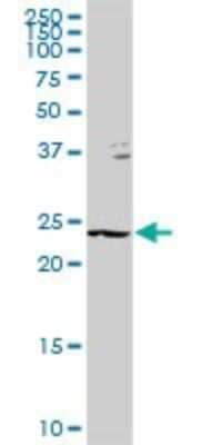 Western Blot: GSTZ1 Antibody [H00002954-D01P] - Analysis of GSTZ1 expression in mouse liver.