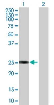 Western Blot: GSTZ1 Antibody [H00002954-D01P] - Analysis of GSTZ1 expression in transfected 293T cell line by GSTZ1 polyclonal antibody.Lane 1: GSTZ1 transfected lysate(24.10 KDa).Lane 2: Non-transfected lysate.