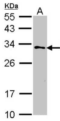 Western Blot: GSTZ1 Antibody [NBP1-33693] - Sample (30 ug of whole cell lysate) A: 293T 12% SDS PAGE; antibody diluted at 1:1000.