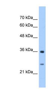 Western Blot: GSTZ1 Antibody [NBP1-55137] - Titration: 2.5ug/ml Positive Control: HepG2 cell lysate.