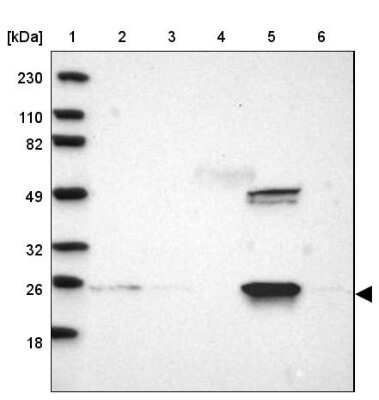 Western Blot: GSTZ1 Antibody [NBP1-83320] - Lane 1: Marker [kDa] 230, 110, 82, 49, 32, 26, 18Lane 2: Human cell line RT-4Lane 3: Human cell line U-251MG spLane 4: Human plasma (IgG/HSA depleted)Lane 5: Human liver tissueLane 6: Human tonsil tissue