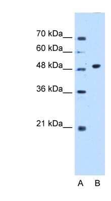 Western Blot: GTDC1 Antibody [NBP1-53078] - Jurkat cell lysate, concentration 0.2-1 ug/ml.