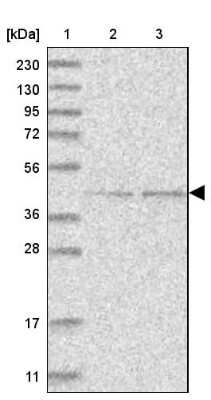 Western Blot: GTDC1 Antibody [NBP1-83725] - Lane 1: Marker  [kDa] 230, 130, 95, 72, 56, 36, 28, 17, 11.  Lane 2: Human cell line RT-4.  Lane 3: Human cell line U-251MG sp