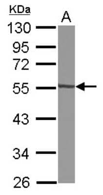 Western Blot: GTDC1 Antibody [NBP2-16759] - Sample (30 ug of whole cell lysate) A: A549 10% SDS PAGE gel, diluted at 1:1000.