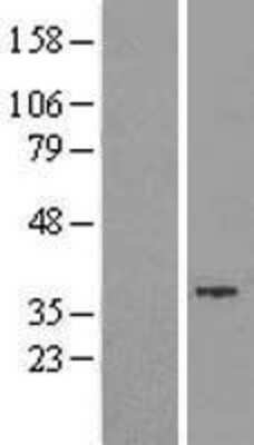 Western Blot: GTDC1 Overexpression Lysate (Adult Normal) [NBL1-11381] Left-Empty vector transfected control cell lysate (HEK293 cell lysate); Right -Over-expression Lysate for GTDC1.