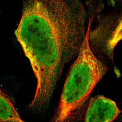 Immunocytochemistry/Immunofluorescence: GTF2A1 Antibody [NBP1-86953] - Immunofluorescent staining of human cell line U-2 OS shows localization to nucleoplasm & cytosol.