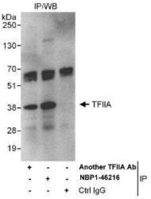 Immunoprecipitation: GTF2A1 Antibody [NBP1-46216] - Whole cell lysate (1 mg for IP, 20% of IP loaded) from HeLa cells.   Affinity purified rabbit anti-GTF2A1/TFIIA antibody used for IP at 3 mcg/mg lysate.  GTF2A1/TFIIA was also immunoprecipitated by another rabbit anti-GTF2A1/TFIIA antibody, which recognizes an upstream epitope.