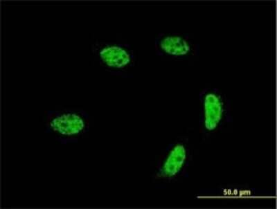 Immunocytochemistry/Immunofluorescence: GTF2A1L Antibody (2E3) [H00011036-M02] - Analysis of monoclonal antibody to GTF2A1L on HeLa cell . Antibody concentration 10 ug/ml.