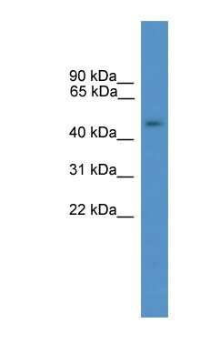 Western Blot: GTF2A1L Antibody [NBP1-69205] - Human Placenta lysate, concentration 0.2-1 ug/ml.