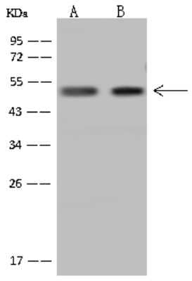 Western Blot: GTF2A1L Antibody [NBP2-97826] - Anti-GTF2A1L rabbit polyclonal antibody at 1:500 dilution. Lane A: U-251 MG Whole Cell Lysate Lane B: Jurkat Whole Cell Lysate Lysates/proteins at 30 ug per lane. Secondary Goat Anti-Rabbit IgG (H+L)/HRP at 1/10000 dilution. Developed using the ECL technique. Performed under reducing conditions. Predicted band size: 52 kDa. Observed band size: 52 kDa