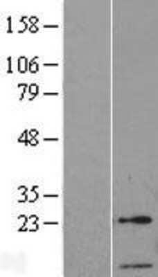 Western Blot GTF2A2 Overexpression Lysate