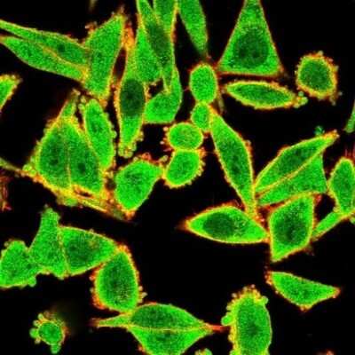 Immunocytochemistry/Immunofluorescence: GTF2H2 Antibody (PCRP-GTF2H2-1B9) [NBP3-08257] - Immunofluorescence Analysis of PFA-fixed HeLa cells. GTF2H2 Mouse Monoclonal Antibody (PCRP-GTF2H2-1B9) followed by goat anti- Mouse IgG-CF488 (green). Phalloidin counterstain (red).