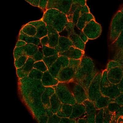 Immunocytochemistry/Immunofluorescence: GTF2H2 Antibody (PCRP-GTF2H2-1B9) [NBP3-08257] - Immunofluorescence Analysis of PFA-fixed MCF7 cells. GTF2H2 Mouse Monoclonal Antibody (PCRP-GTF2H2-1B9) followed by goat anti- Mouse IgG-CF488 (green). Phalloidin counterstain (red).