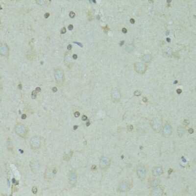 Immunohistochemistry-Paraffin: GTF2H2C Antibody [NBP3-05591] - Immunohistochemistry of paraffin-embedded rat brain using GTF2H2C antibody (NBP3-05591) at dilution of 1:100 (40x lens).
