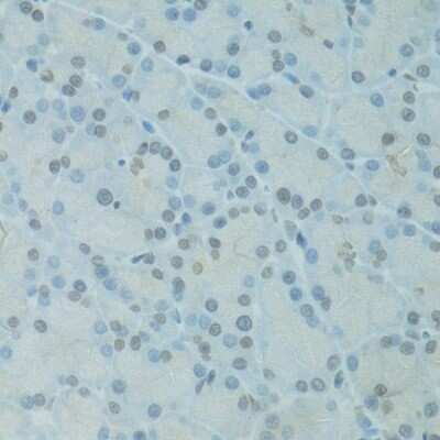 Immunohistochemistry-Paraffin: GTF2H2C Antibody [NBP3-05591] - Immunohistochemistry of paraffin-embedded rat pancreas using GTF2H2C antibody (NBP3-05591) at dilution of 1:100 (40x lens).