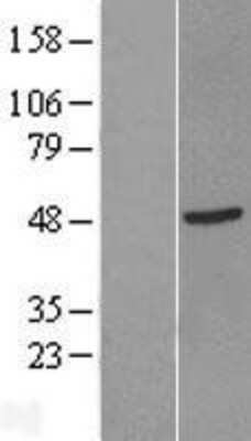 Western Blot GTF2H2D Overexpression Lysate