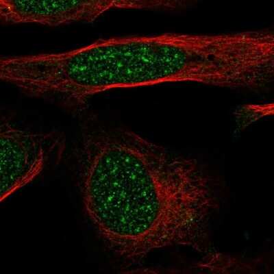 Immunocytochemistry/Immunofluorescence: GTF2H4 Antibody [NBP2-57537] - Staining of human cell line U-2 OS shows localization to nuclear speckles.