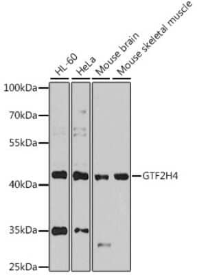 Western Blot: GTF2H4 Antibody [NBP3-04644] - Analysis of extracts of various cell lines, using GTF2H4 antibody at 1:1000 dilution. Secondary antibody: HRP Goat Anti-Rabbit IgG (H+L) at 1:10000 dilution. Lysates/proteins: 25ug per lane. Blocking buffer: 3% nonfat dry milk in TBST. Detection: ECL Enhanced Kit