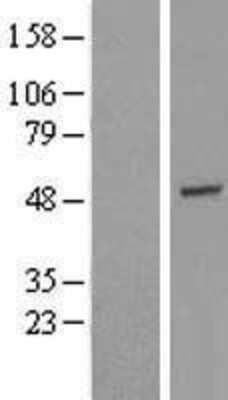 Western Blot: GTF2H4 Overexpression Lysate (Adult Normal) [NBL1-11391] Left-Empty vector transfected control cell lysate (HEK293 cell lysate); Right -Over-expression Lysate for GTF2H4.