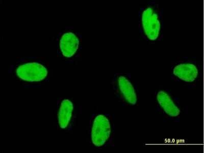 Immunocytochemistry/Immunofluorescence: GTF2IRD2 Antibody [H00084163-B01P] - Analysis of purified antibody to GTF2IRD2 on HeLa cell. (antibody concentration 10 ug/ml)