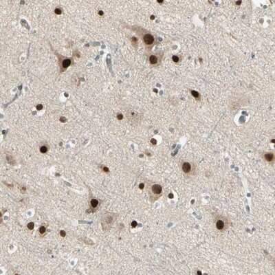 Immunohistochemistry-Paraffin: GTF3A Antibody [NBP1-89064] - Staining of human cerebral cortex shows strong nuclear positivity in neuronal cells and glial cells.