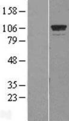 Western Blot: GTF3C2 Overexpression Lysate (Adult Normal) [NBP2-08586] Left-Empty vector transfected control cell lysate (HEK293 cell lysate); Right -Over-expression Lysate for GTF3C2.