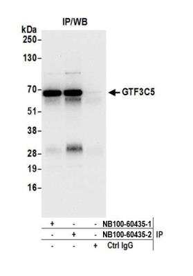 Immunoprecipitation: GTF3C5 Antibody [NB100-60435] - Detection of human GTF3C5 by western blot of immunoprecipitates. Samples: Whole cell lysate (0.5 or 1.0 mg per IP reaction; 20% of IP loaded) from HEK293T cells prepared using NETN lysis buffer. Antibodies: Affinity purified rabbit anti-GTF3C5 antibody NB100-60435 (lot NB100-60435-2) used for IP at 6 ug per reaction. GTF3C5 was also immunoprecipitated by a previous lot of this antibody (lot NB100-60435-1). For blotting immunoprecipitated GTF3C5, NB100-60435 was used at 0.4 ug/ml. Detection: Chemiluminescence with an exposure time of 10 seconds.