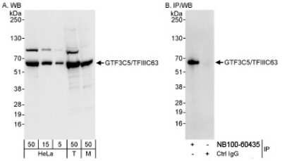 Western Blot: GTF3C5 Antibody [NB100-60435] - Whole cell lysate from HeLa (5, 15 and 50 ug for WB; 1 mg for IP, 20% of IP loaded), 293T (T; 50 ug), and mouse NIH3T3 (M; 50 ug) cells. NB100-60435 used for WB at 0.04 ug/ml (A) and 1 ug/ml (B) and used for IP at 3 ug/mg lysate.