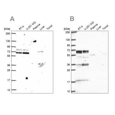 Western Blot: GTF3C5 Antibody [NBP2-49504] - Analysis using Anti-GTF3C5 antibody NBP2-49504 (A) shows similar pattern to independent antibody NBP2-55707 (B).