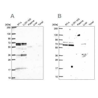 Western Blot: GTF3C5 Antibody [NBP2-55707] - Analysis using Anti-GTF3C5 antibody NBP2-55707 (A) shows similar pattern to independent antibody NBP2-49504 (B).