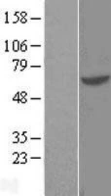 Western Blot: GTF3C5 Overexpression Lysate (Adult Normal) [NBL1-11396] Left-Empty vector transfected control cell lysate (HEK293 cell lysate); Right -Over-expression Lysate for GTF3C5.