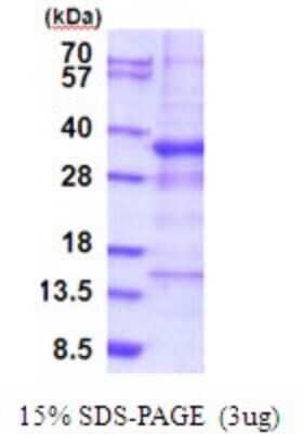 SDS-Page: GTF3C6 Recombinant Protein [NBP2-51894] - 15% SDS Page (3 ug)
