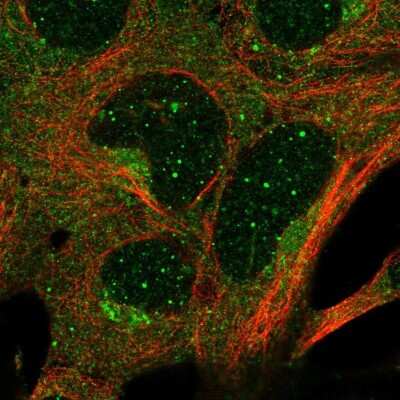 Immunocytochemistry/Immunofluorescence: GTP-binding protein 1 Antibody [NBP2-56040] - Staining of human cell line HEK 293 shows localization to nuclear bodies, cytosol &amp; the Golgi apparatus.