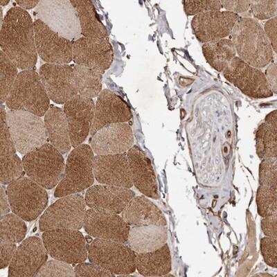 Immunohistochemistry: GTP-binding protein 1 Antibody [NBP1-89746] - Staining of human skeletal muscle shows positivity in myocytes.