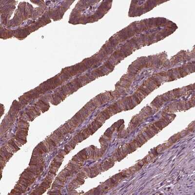 Immunohistochemistry-Paraffin: GTP-binding protein 1 Antibody [NBP2-56040] - Staining of human fallopian tube shows moderate cytoplasmic positivity in glandular cells.