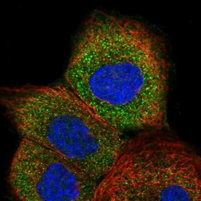 Immunocytochemistry/Immunofluorescence: GTPBP2 Antibody [NBP1-85924] - Staining of human cell line A-431 shows localization to vesicles. Antibody staining is shown in green.