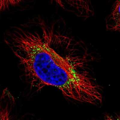 Immunocytochemistry/Immunofluorescence: GTPBP2 Antibody [NBP2-58755] - Staining of human cell line HeLa shows localization to vesicles.