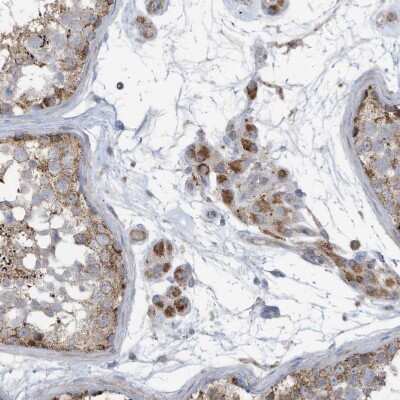 Immunohistochemistry-Paraffin: GTPBP2 Antibody [NBP1-85924] - Staining of human testis shows moderate cytoplasmic positivity in cells in seminiferous ducts.