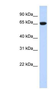 Western Blot: GTPBP2 Antibody [NBP1-57648] - Transfected 293T cell lysate, concentration 0.2-1 ug/ml.