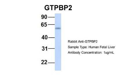 Western Blot: GTPBP2 Antibody [NBP1-57648] - Human Fetal Liver, Antibody Dilution: 1.0 ug/ml.