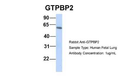 Western Blot: GTPBP2 Antibody [NBP1-57648] - Human Fetal Lung, Antibody Dilution: 1.0 ug/ml.