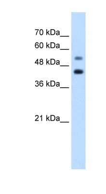 Western Blot: GTPBP2 Antibody [NBP1-57649] - Jurkat cell lysate, concentration 1.25ug/ml.