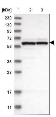 Western Blot: GTPBP2 Antibody [NBP1-85924] - Lane 1: Marker  [kDa] 230, 130, 95, 72, 56, 36, 28, 17, 11.  Lane 2: Human cell line RT-4.  Lane 3: Human cell line U-251MG sp