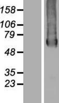 Western Blot: GTPBP2 Overexpression Lysate (Adult Normal) [NBP2-06722] Left-Empty vector transfected control cell lysate (HEK293 cell lysate); Right -Over-expression Lysate for GTPBP2.